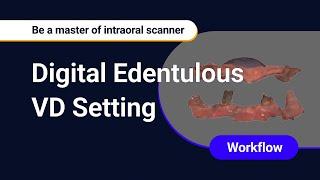 Digital Edentulous VD Setting