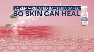 SkinSmart for eczema