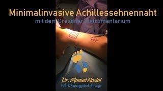 Die minimalinvasive Achillessehnennaht mit dem Dresdner-Instrumentarium