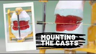 Mounting the casts on a mean value articulator | DEMO