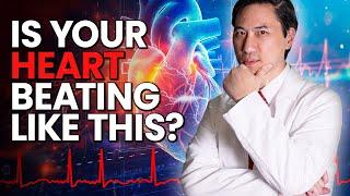 AFib Explained: What You Need to Know About Atrial Fibrillation