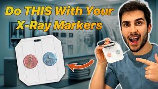 The BEST Way to Tape Your X-Ray Markers