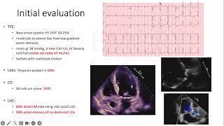 Contemporary Complex PCI Cases