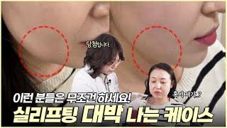 이런 분들은 실리프팅 무조건 하세요! 실리프팅하면 대박 나는 케이스 알려드림!