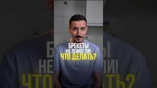 Брекеты не помогли?