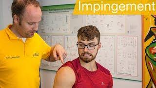 Impingement Syndrom Schulter ️Übungen | Ursachen | Test | Behandlung