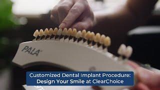 Customized Dental Implant Procedure: Design Your Smile at ClearChoice