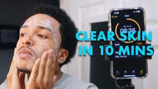 Clear Skin in 10 Minutes a Day (Skincare Routine for Men)