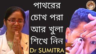 Artificial eye wearing and removal explained in Bengali | Step by step | Dr Sumitra