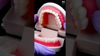 iDENTical Dental Model MD-105N - Essential Tool for Patient Education in Oral Hygiene