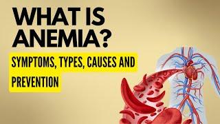 Anemia, symptoms of anemia ,Causes of anemia, How can you prevent anemia?