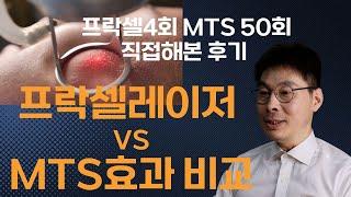 직접 해보고 알았어요 | 프락셀 레이저 vs MTS