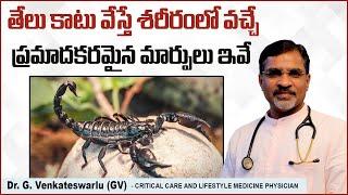 తేలు కాటు వేస్తే | Unknown Facts About Scorpion Bite In Telugu | Health Facts | Sriraksha Hospital