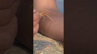 لدغة عنكبوت الجمل