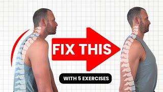 Perfect Your Posture in 5 Moves | Quick & Easy Exercises