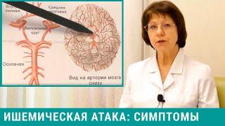 Ишемическая атака головного мозга: симптомы. Как мы лечим ишемические атаки