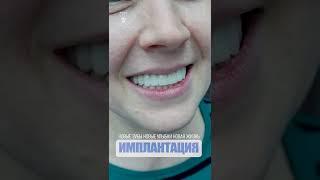 Новые зубы новые улыбки новая жизнь. New teeth, new smiles, new life. Implantation.