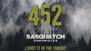 SC EP:452 I shot it in the throat