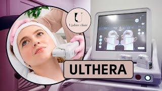 СМАС-ЛИФТИНГ на аппарате ULTHERA / АЛЬТЕРА в Update Clinic