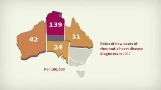 Cardiovascular health among Aboriginal and Torres Strait Islander people