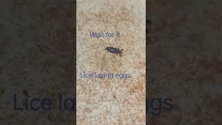 Lice removal | live lice egg laying | gross  | subscribe for more