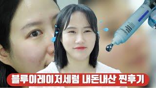 여드름안생기는법? 여드름관리 트러블삭제 sns핫템 블루이레이저세럼 내돈내산 솔직후기