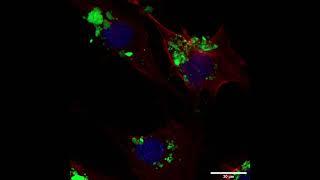 MBGNs for delivery of therapeutic agents - Supplementary video 3 [ID 397297]