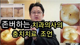 폭망한 치과의사의  초기 충치 치료  주의할 점