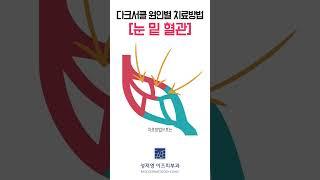 다크서클 원인별 치료방법 [눈 밑 혈관]
