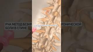 Лечение хронической боли в спине шеи голове без скальпеля