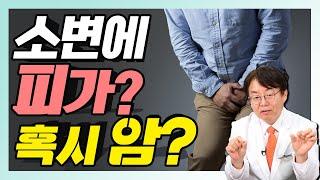'이런 사람' 방광내시경 꼭 해야 합니다! - 쉬편한세상 #10 방광내시경 후기 방광내시경 여성 방광내시경 고통