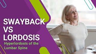 Swayback vs Lordosis: Hyperlordosis of the Lumbar Spine