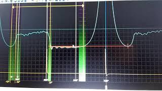 Рено Логан двигатель 1,4 K7J. Горит чек. Комплексная диагностика двигателя. #диагностикарено