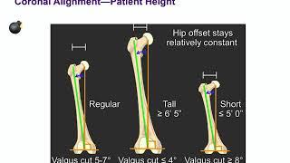 Primary Knee Replacement - ABOS Orthopedic Surgery Board Exam Review