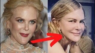 PLASTIC SURGERY AT THE AGE OF 54! Nicole Kidman surprised with her new appearance