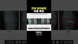 닳아없어진 무릎 특징 #무릎통증