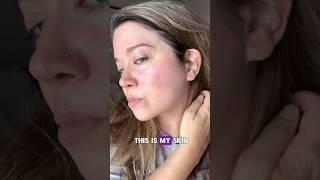A Youthful Glow at 40 
