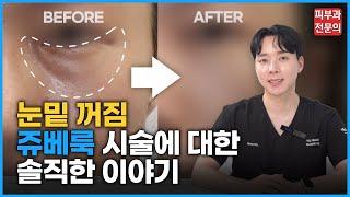 눈밑꺼짐｜ 자연스럽게 해결 ｜쥬베룩 ｜필러 ｜ 리쥬란｜솔직한 이야기