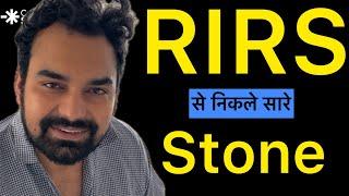 गुर्दे की पथरी का इलाज | RIRS से Kidney stone treatment |RIRS Patient Testimonial #rirs #kidneystone