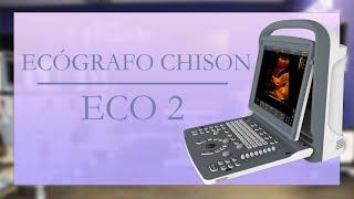 CHISON Eco 2: El ecógrafo portátil con mejor calidad-precio del mercado