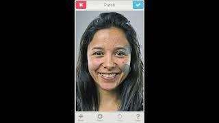 Facetune: Skin Treatment