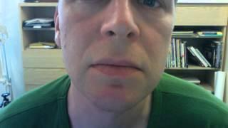 Bells Palsy Facial Twitching - My chin