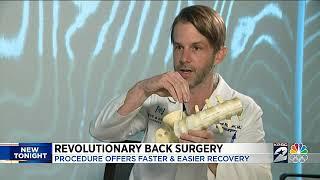 Revolutionary spine surgery takes pain, long recovery away for most patients