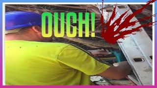  Chainsaw Accident Horrible Hand & Finger caught on film slow motion - ALWAYS wear GLOVES