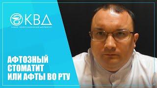 1279  Афтозный стоматит или афты во рту