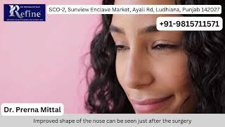 Rhinoplasty in Himachal | Cost of NoseJob | Refine Aesthetic Clinic - Dr Prerna Mittal (M)9815711571