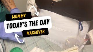 Mommy Makeover Pt. 2 (Today's The Day)