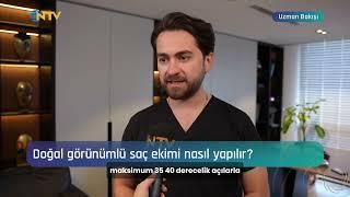 UZMAN BAKIŞI | SAÇ EKİMİNDE DHI YÖNTEMİNİN AVANTAJLARI | DR.BURAK TUNCER