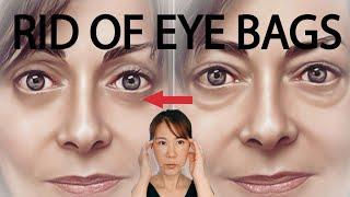 GET RID OF EYE BAGS FAST! Naturally at home. Why spend the $$?