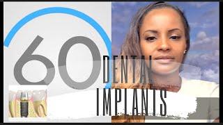 Dentist Implant: 60 Second Dental Answers with Dr. Denis the Dentist